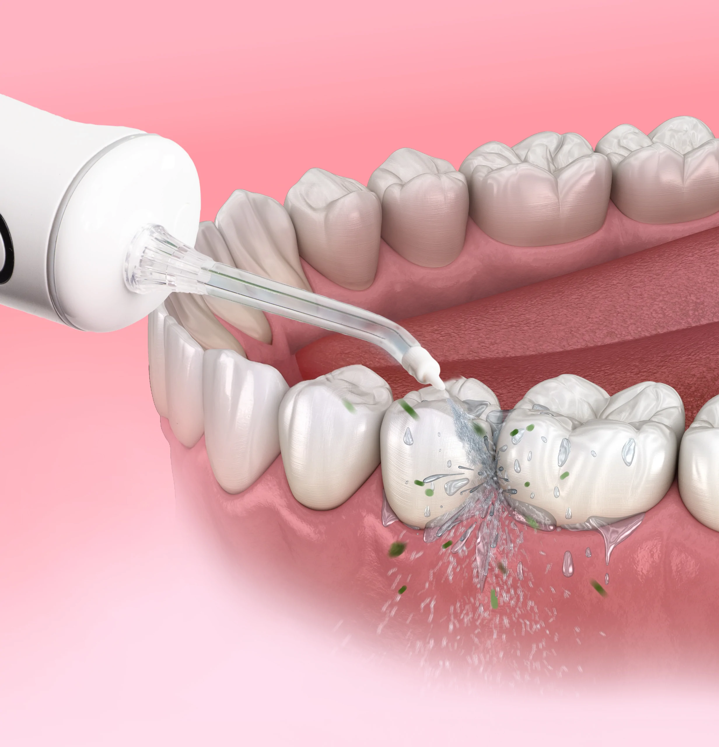 ProbiWash periodontal baslik