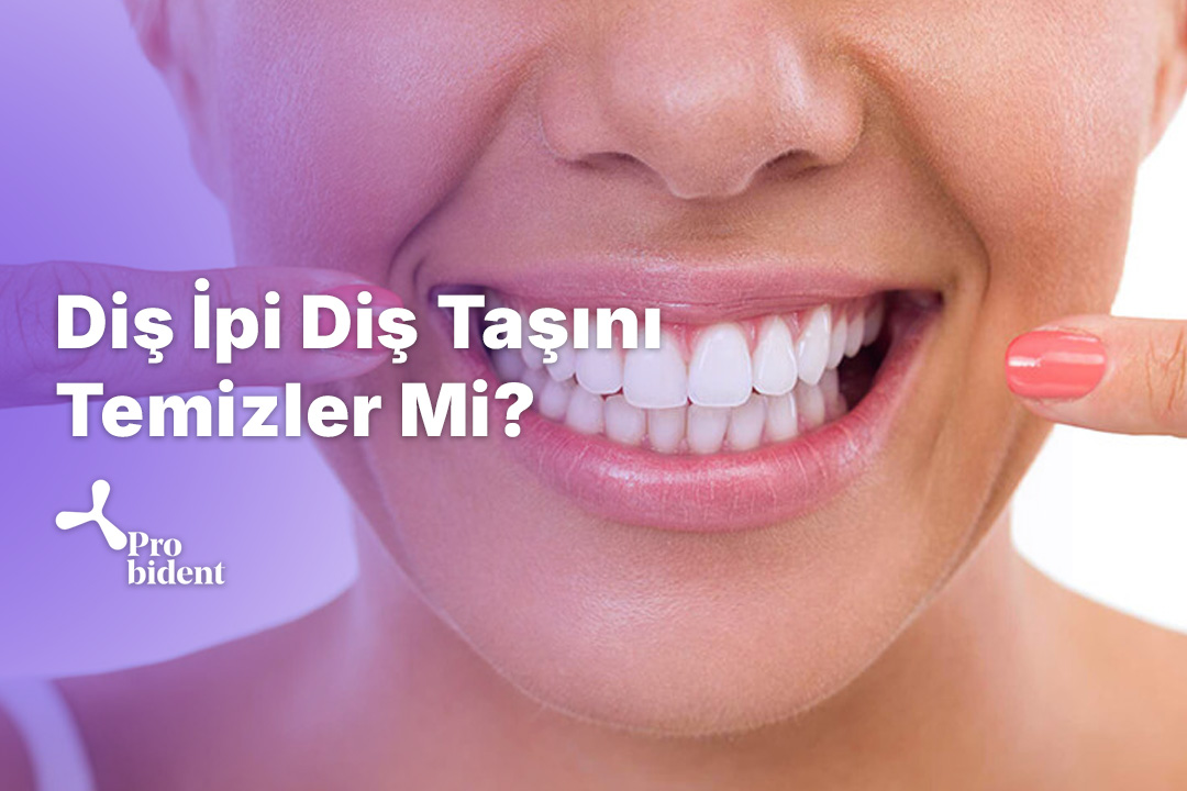 Diş İpi Diş Taşını Temizler Mi